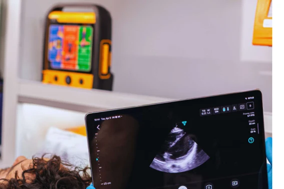 Ultrassom Portátil Sem Fio